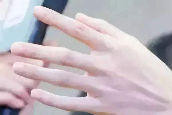 皮肤干裂治疗方法(皮肤干裂如何治疗)