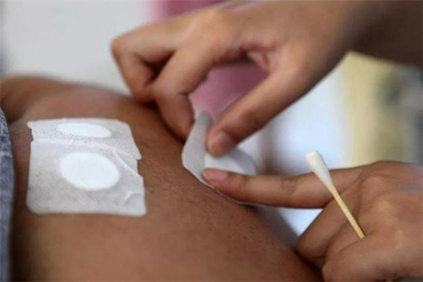 三伏贴有哪些不良反应(三伏贴有哪些不良反应)