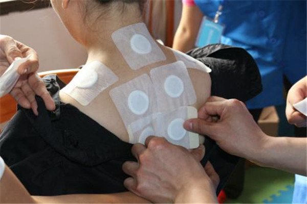 三伏贴禁忌人群(三伏贴禁忌人群有哪些)