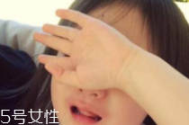 孩子摔伤要注意哪些(孩子摔了应该注意什么?)