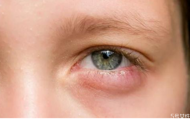 美瞳可以用水泡吗(美瞳可以用水泡吗一晚上)