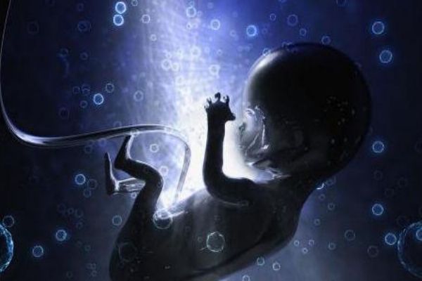 羊水过多的分类(羊水过多的分类)