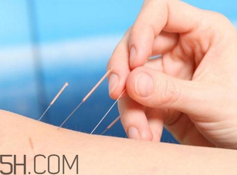 关节炎常见疗法(关节炎的最佳治疗方法)