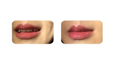 网友怎么看(爱奇艺裁员网友怎么看)