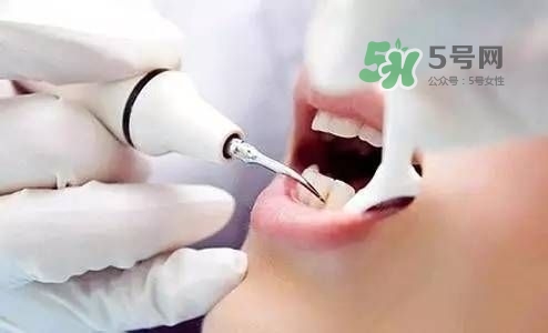 糖醋排骨正宗做法(正宗糖醋排骨的做法)