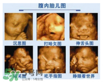 警惕!让胎儿畸形的“雷区”(防止胎儿畸形)