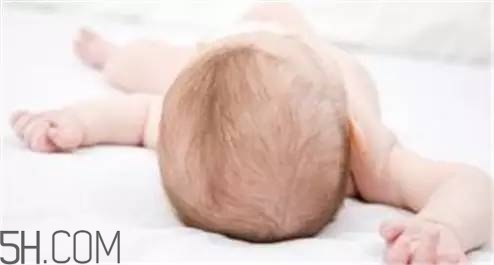 宝宝掉头发的病因(儿童掉头发是因为什么原因引起的) 宝宝掉头发的病因(儿童掉头发是因为什么原因引起的)