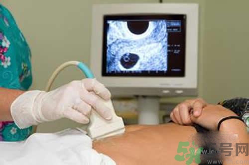 孕妇做b超要憋尿吗(做b超检查怀孕需要憋尿吗)