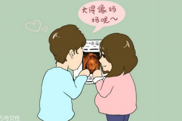 四维彩超检查哪些项目(四维彩超一共检查几项)