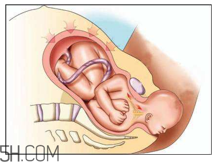 什么叫无痛分娩(什么是无痛分娩和顺产有什么区别)